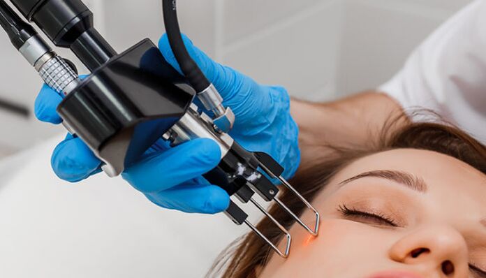 resurfacing della cicatrice con laser