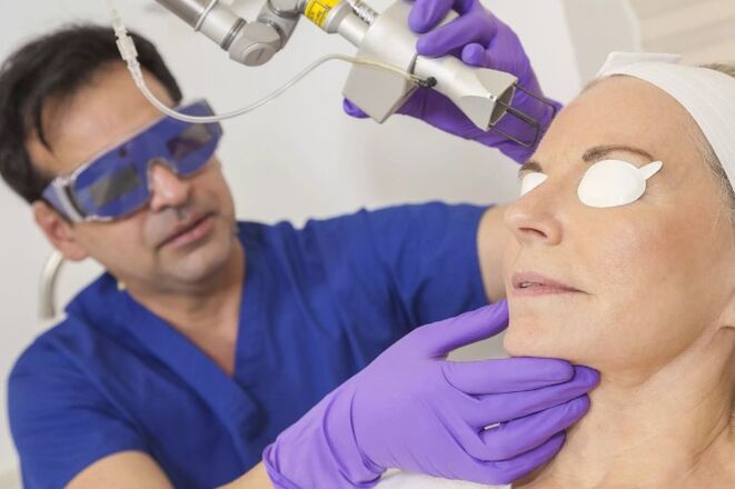 Ringiovanimento della pelle con un laser