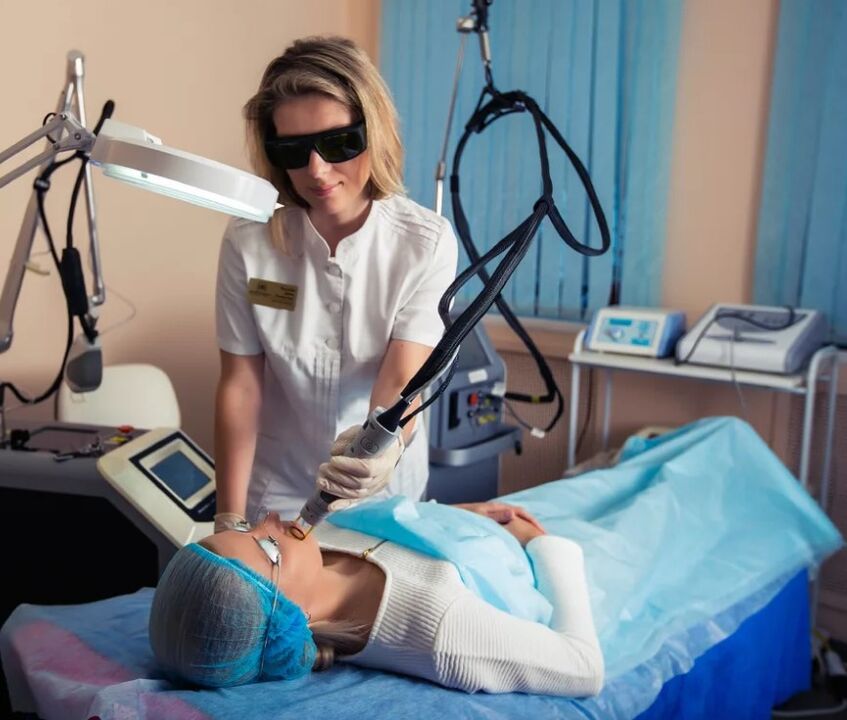 Apparato laser per ringiovanimento del viso